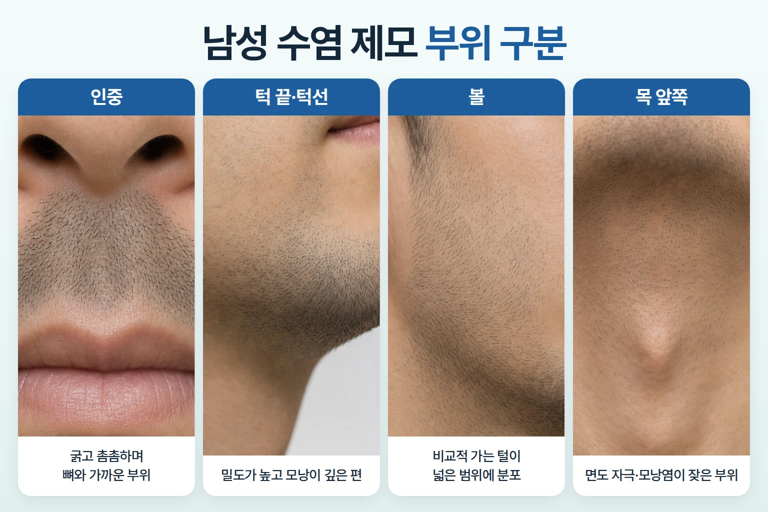인중, 턱 끝과 턱선, 볼, 목 앞쪽 수염 부위를 구역별로 나눠 보여주는 남성 하관 비교 사진