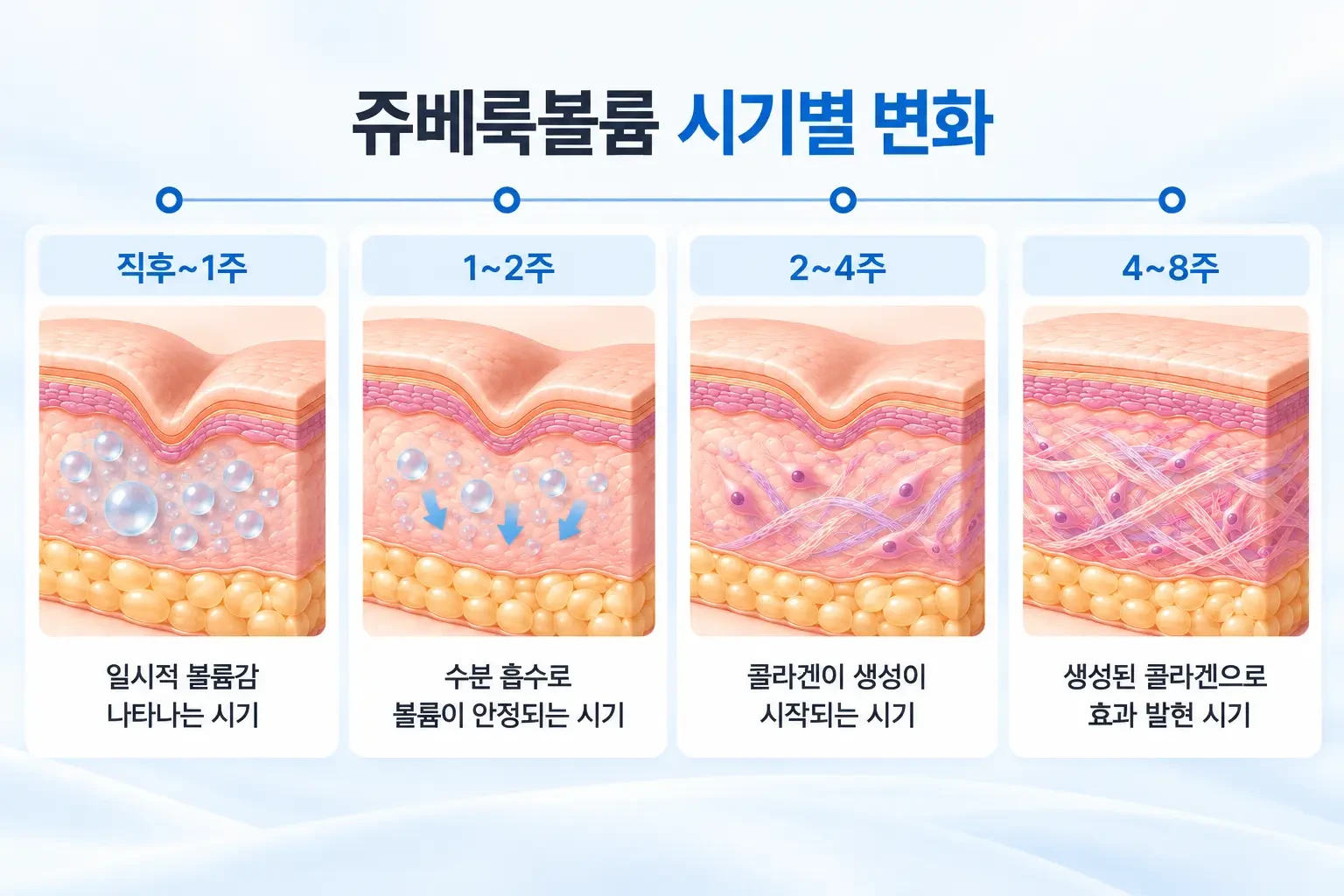 쥬베룩볼륨 주입 직후부터 3개월 이후까지 수분 볼륨 감소와 콜라겐 형성 시점을 정리한 흐름