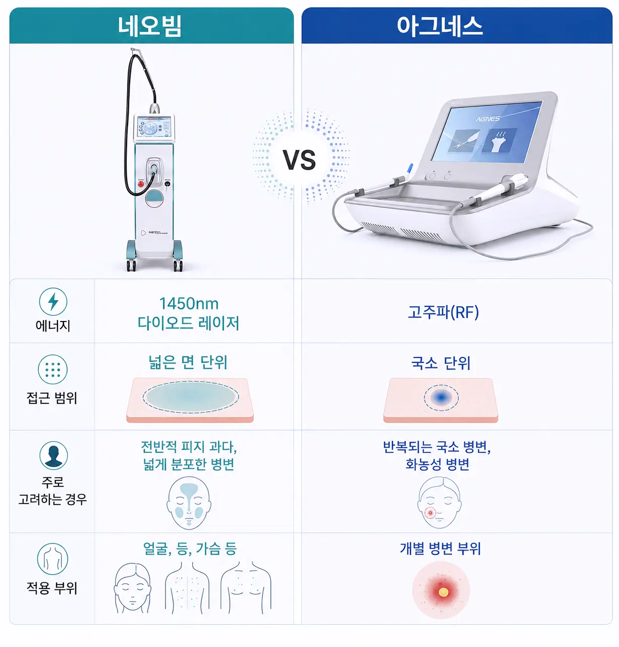 광명여드름치료에 활용되는 네오빔과 아그네스의 에너지 및 적용 범위 비교
