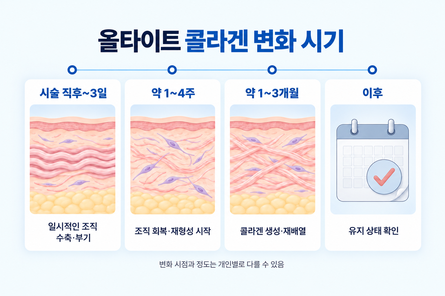 올타이트 시술 직후부터 3일, 1~4주, 1~3개월까지 콜라겐 변화와 조직 회복 과정을 나타낸 이미지
