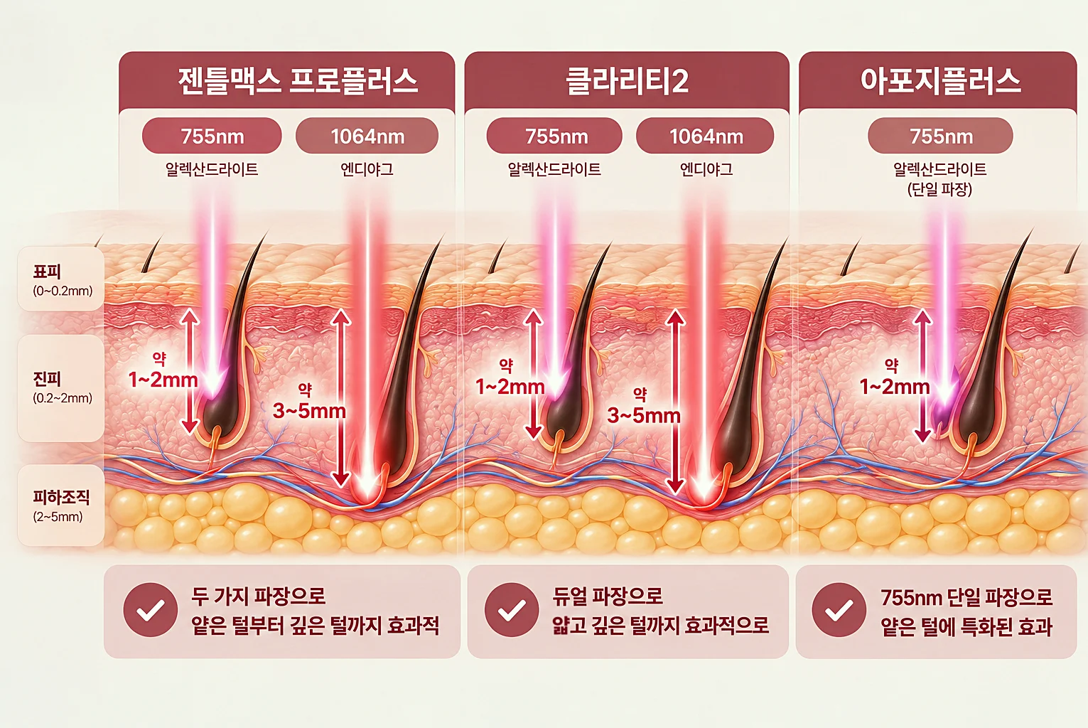 레이저 제모 클라리티2 젠틀맥스 프로 플러스 아포지 플러스 장비별 파장 깊이 차이 비교