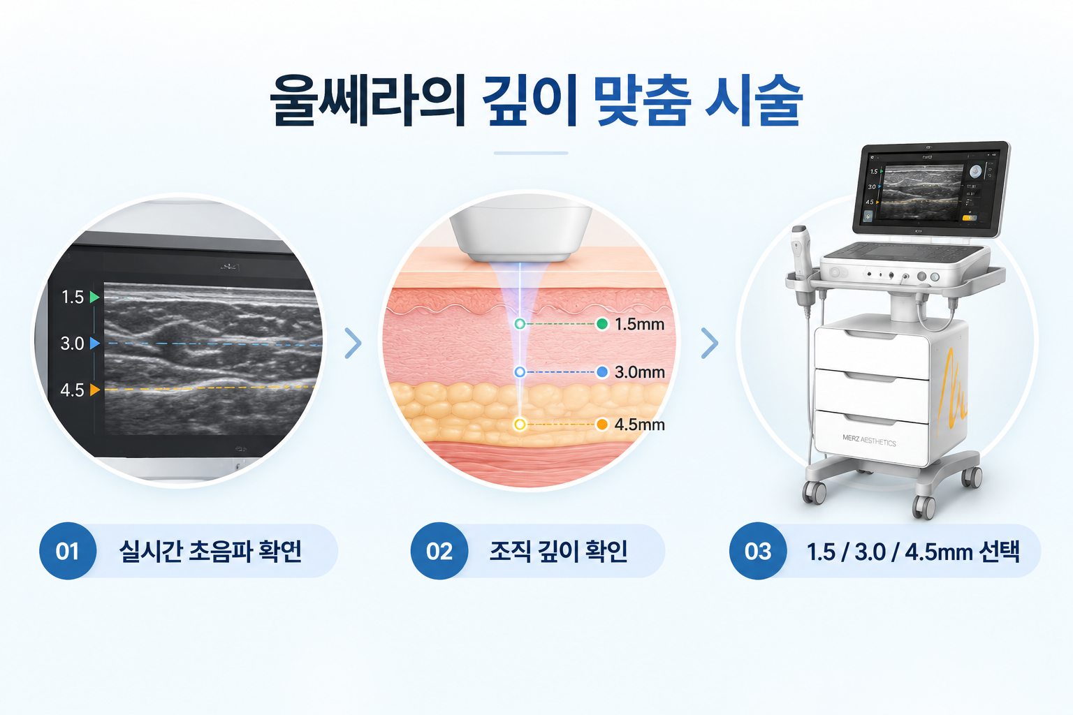 울쎄라피 프라임 실시간 초음파로 확인하는 1.5mm 3.0mm 4.5mm 치료 깊이