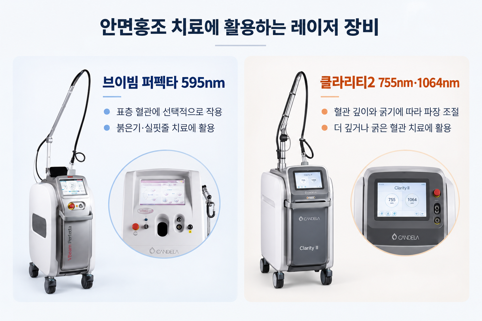 안면홍조 595nm 레이저의 헤모글로빈 흡수와 혈관 응고 과정