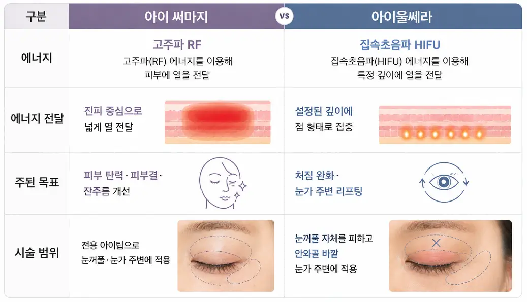아이 써마지와 아이울쎄라의 에너지 전달 방식과 시술 범위 차이