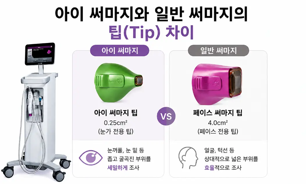 아이 써마지와 일반 써마지의 전용 팁 크기 및 적용 부위 차이