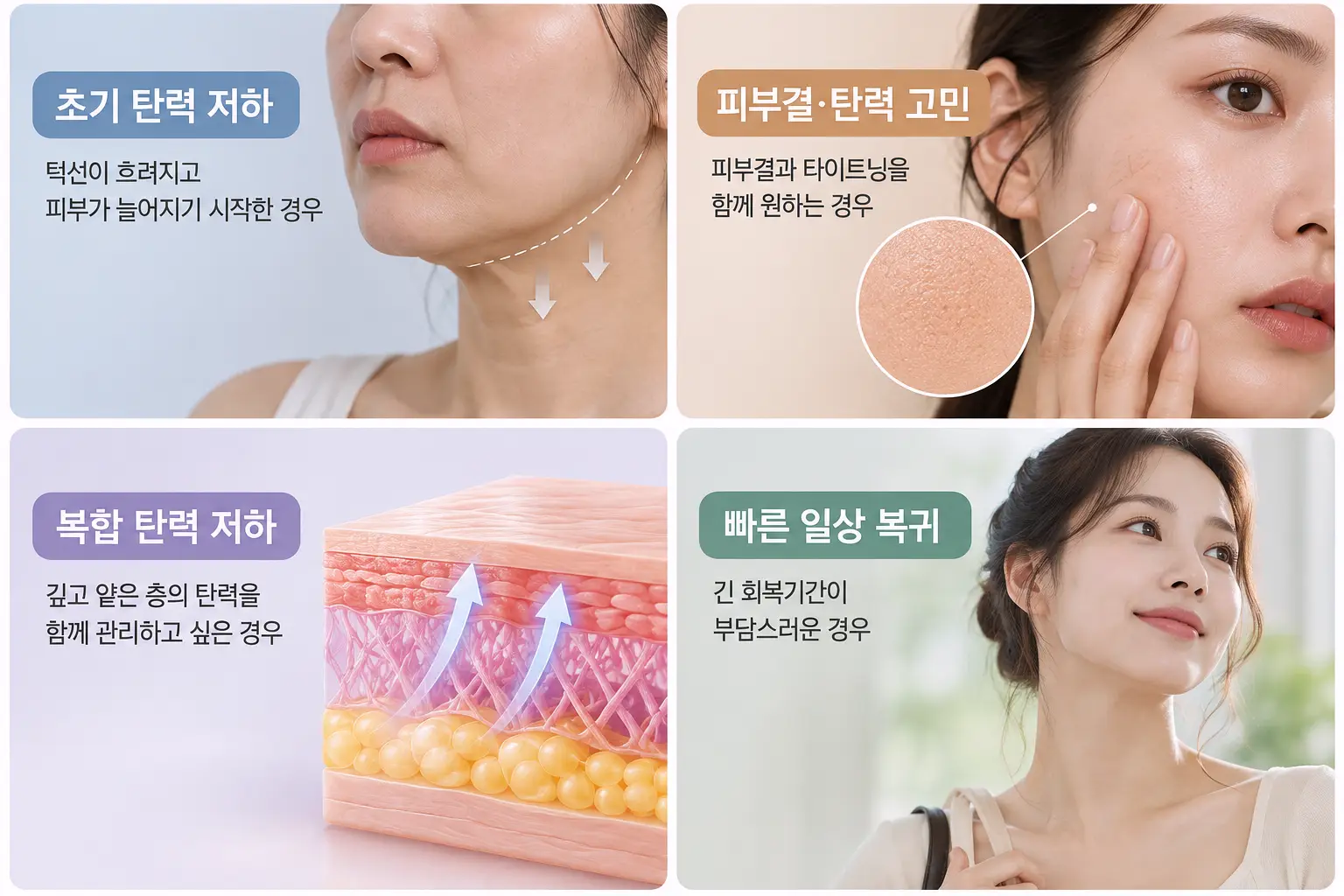 피부 고민에 따른 덴서티 시술 선택 기준