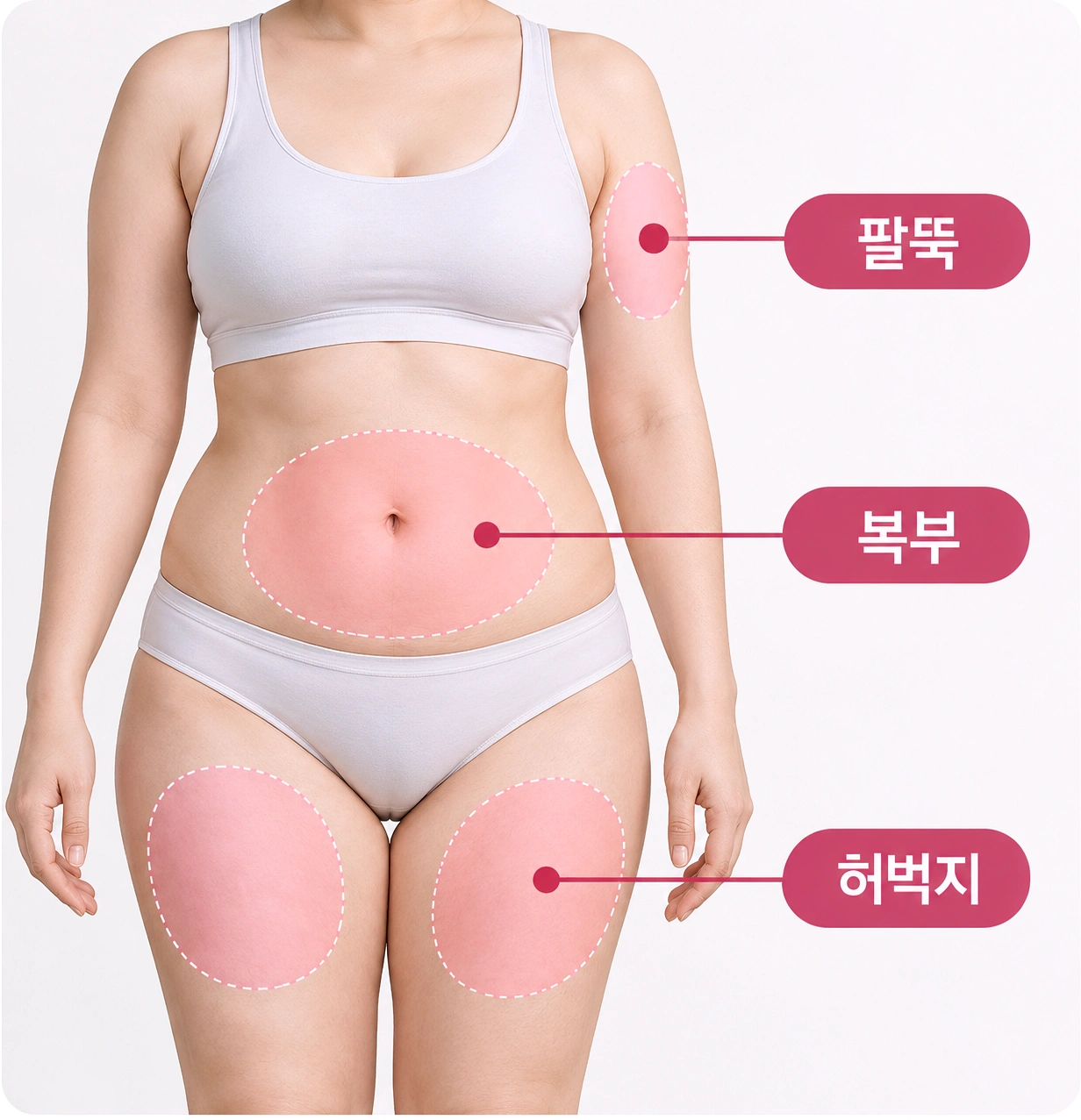 팔뚝·복부·허벅지에 적용할 수 있는 바디 인모드 부위