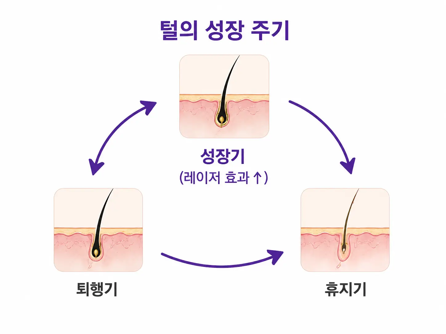 대구 레이저 제모 효과가 잘 나타나는 모발 성장 주기