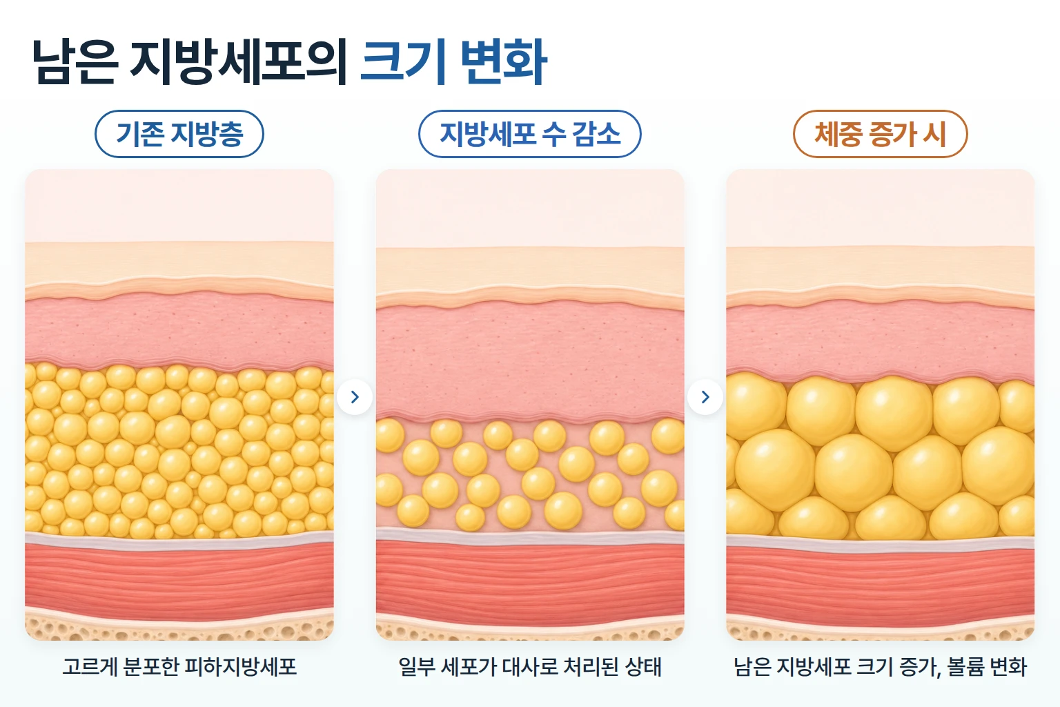 인모드 FX 이후 지방세포 수가 줄고 체중 증가 시 남은 세포가 커지는 변화를 비교한 단면도