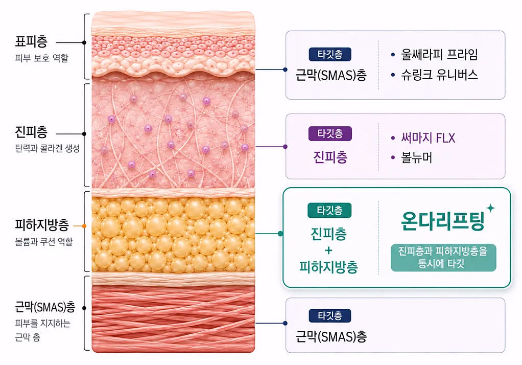 리프팅 시술별 작용 층 비교 - 근막층 진피층 피하지방층 구분도