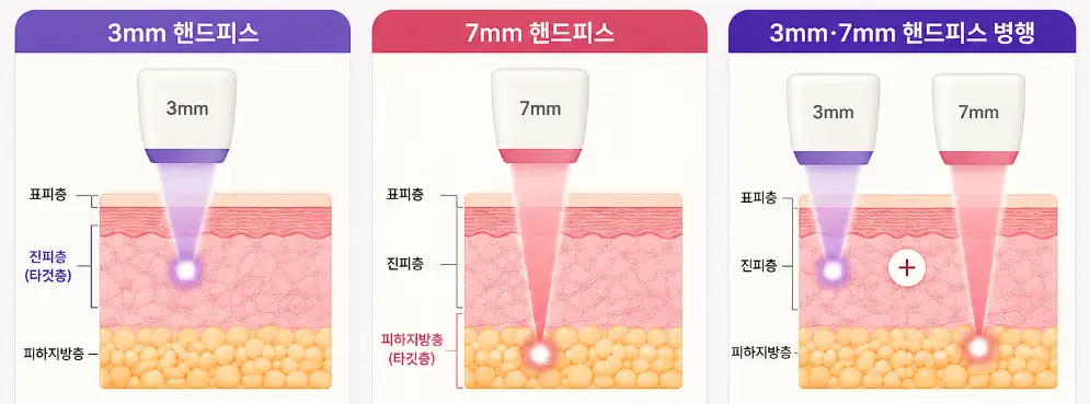 온다 리프팅 3mm·7mm 핸드피스의 타깃층과 작용 깊이 차이