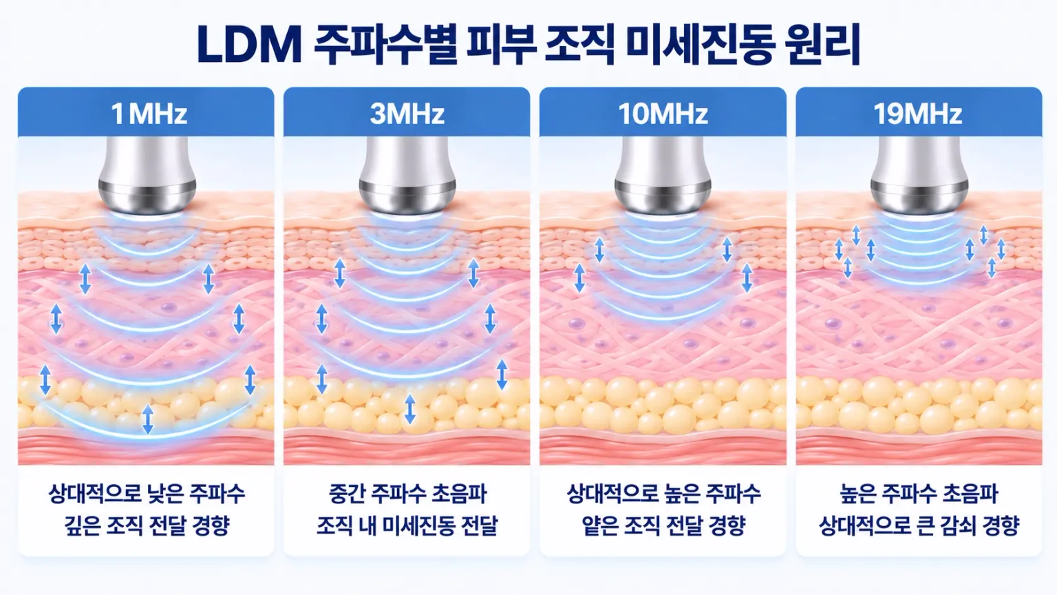 LDM 주파수별 초음파 전달 깊이와 피부 조직 미세진동 원리 비교