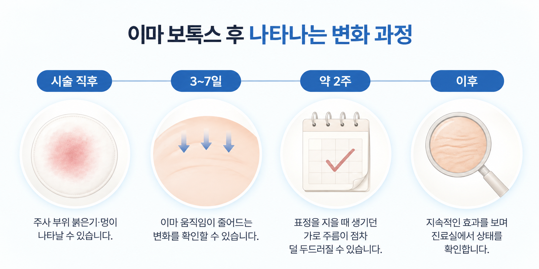 이마 주름 보톡스 후 3~7일부터 나타나는 이마 움직임 변화 과정