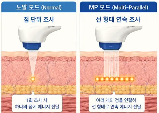 슈링크 유니버스 노말 MP 모드 차이