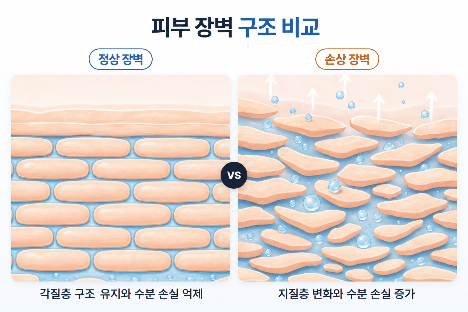 피부결이 거칠어지는 원인인 피부 장벽 손상, 촘촘한 정상 각질층과 지질 배열이 흐트러져 수분 손실이 증가한 손상 각질층 비교