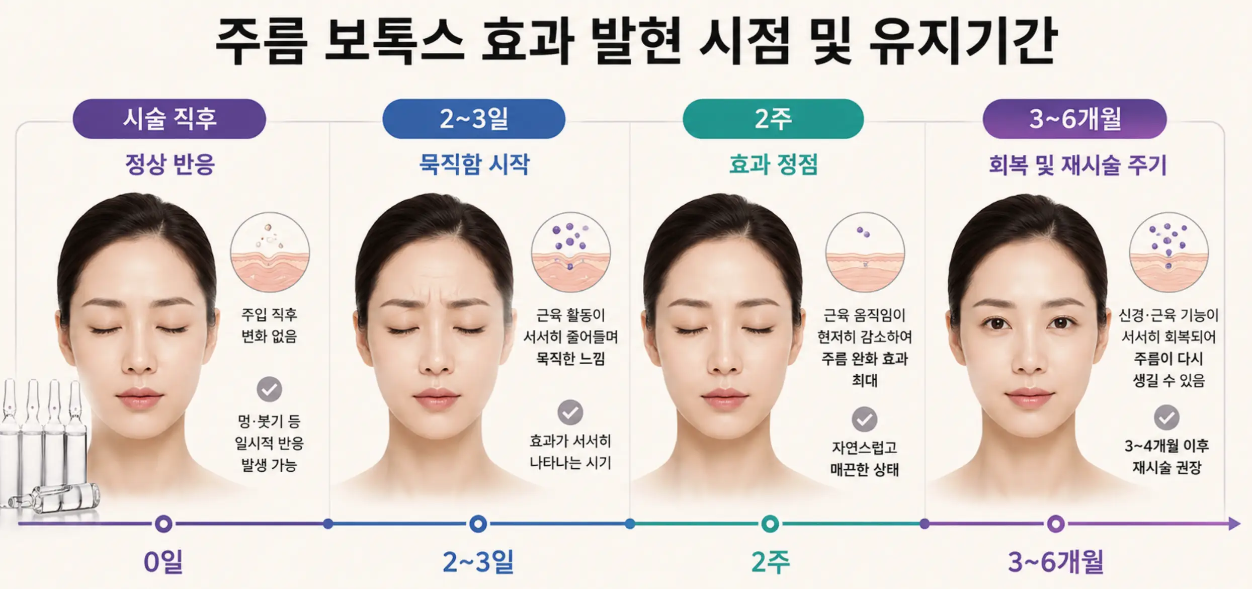 주름 보톡스 2주 정점 효과 발현 시점과 3~6개월 유지기간 및 재시술 주기 타임라인