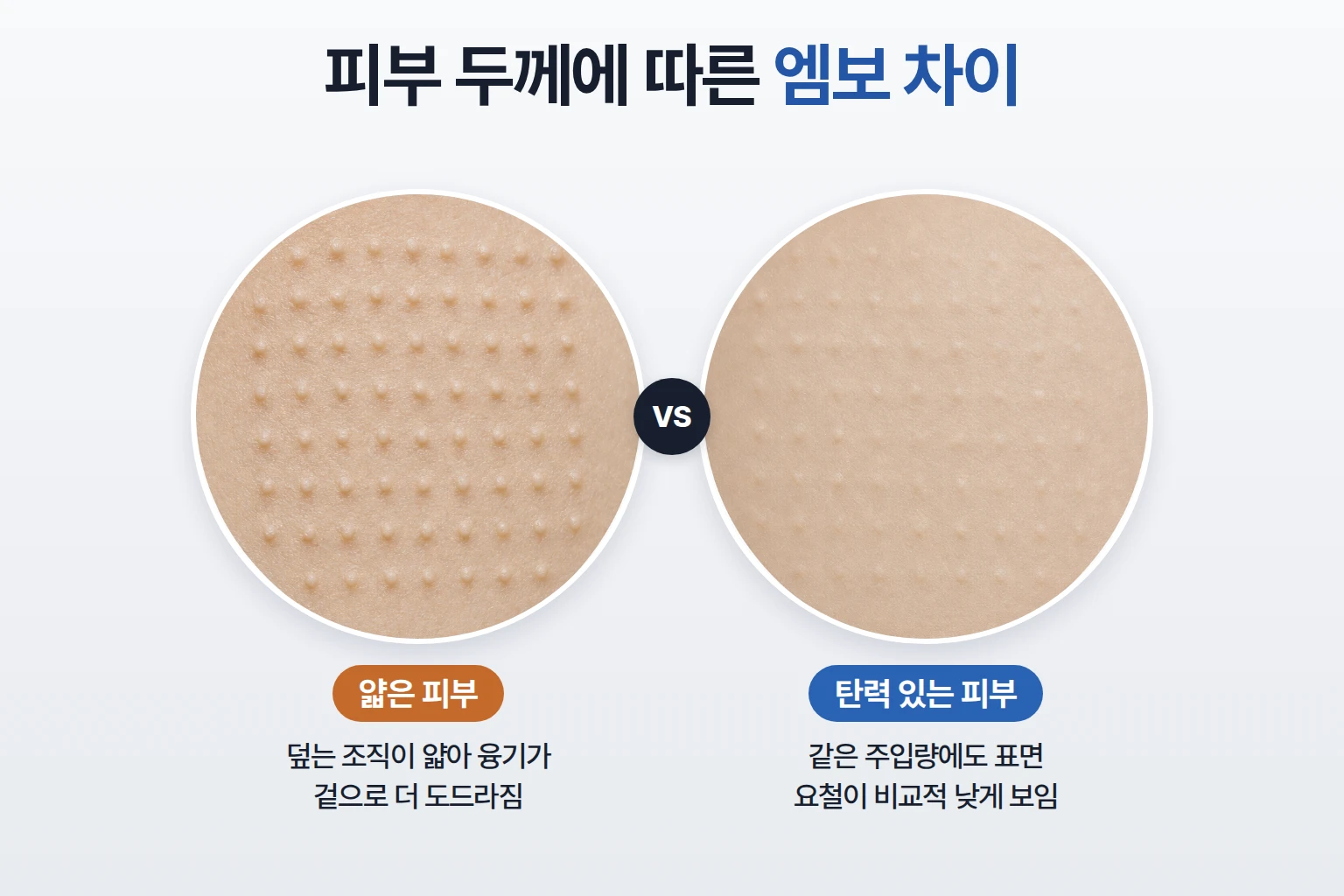 얇은 피부와 탄력 있는 피부에 같은 간격으로 생긴 엠보 융기 높이를 비교한 피부 확대 사진