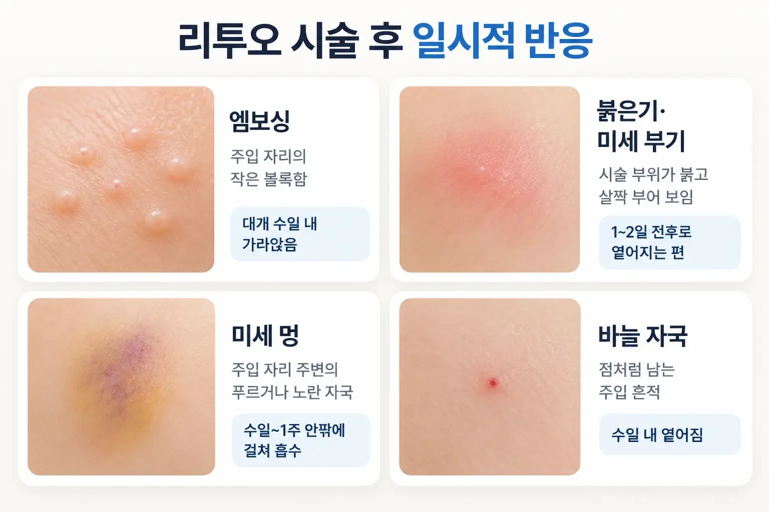 리투오 시술 후 엠보싱, 붉은기, 미세 멍, 바늘 자국의 모습과 회복 흐름을 정리한 관리 이미지