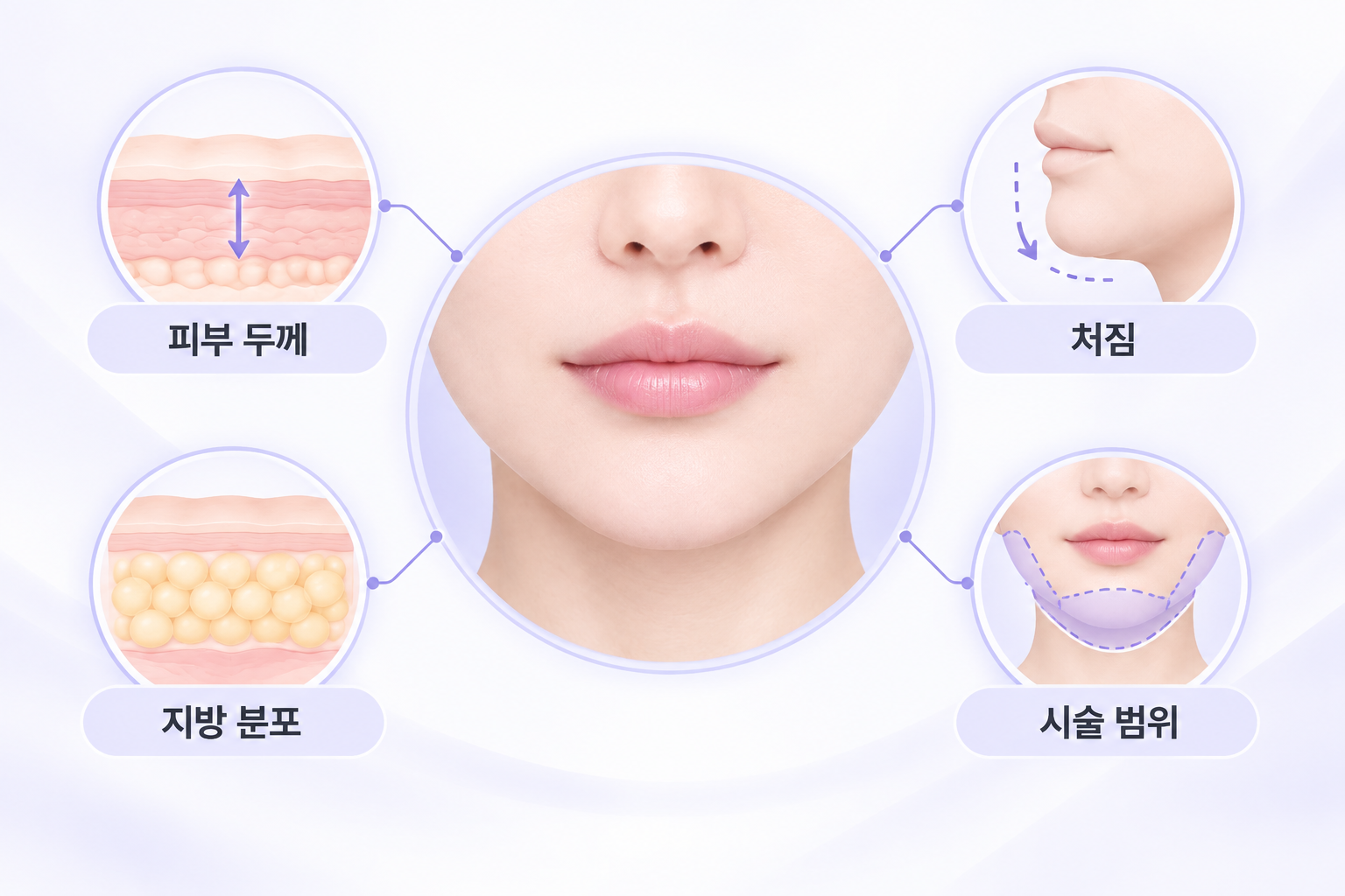 슈링크 유니버스 효과 차이에 영향을 주는 피부 두께, 처짐, 지방 분포, 시술 범위