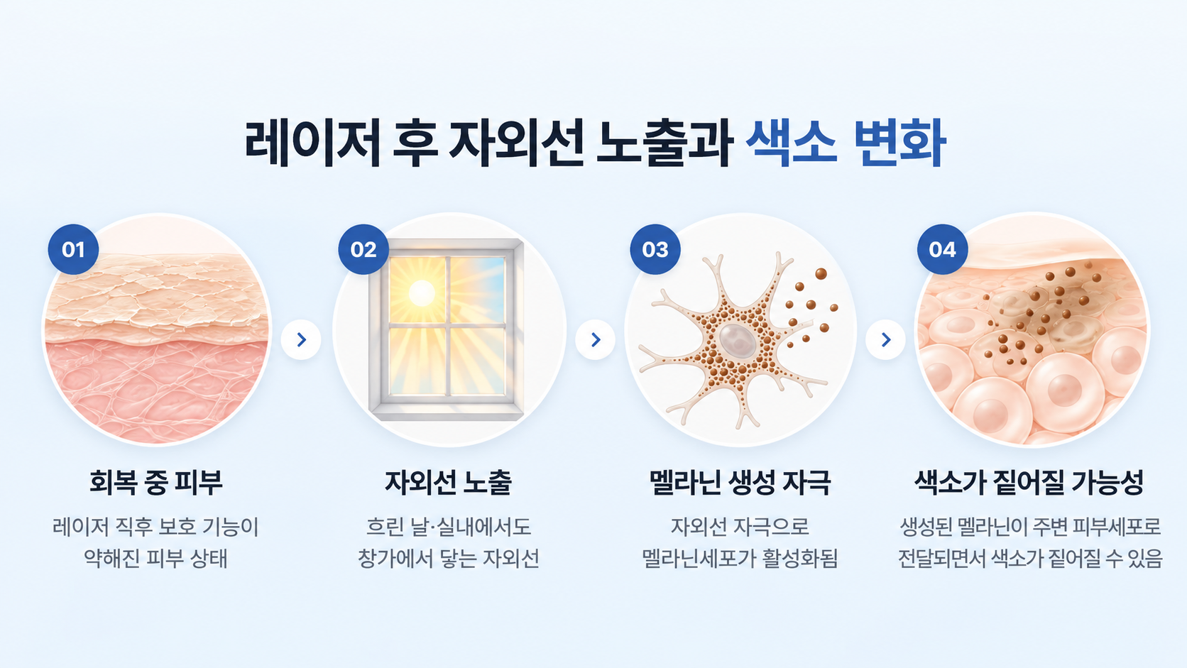잡티 제거 레이저 후 자외선 노출로 멜라닌세포가 자극받고 생성된 색소가 주변 피부세포로 전달되면서 피부색이 짙어질 수 있는 과정