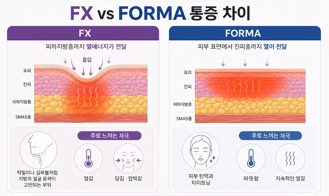 인모드 FX와 FORMA의 에너지 전달 방식 및 통증 차이