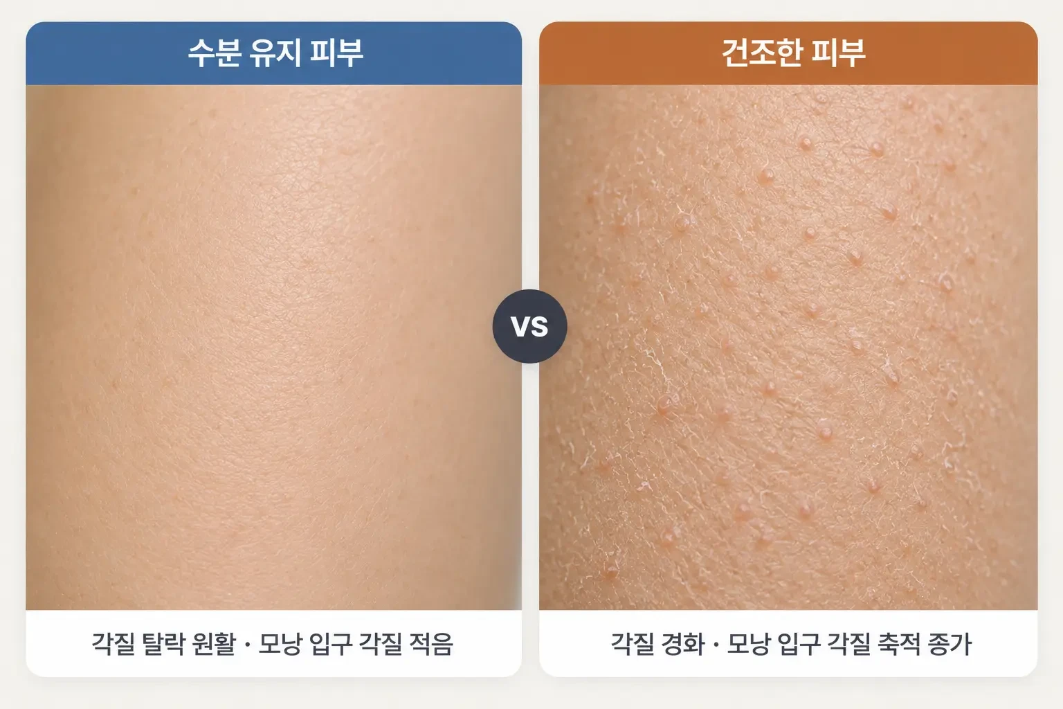 촉촉한 팔 피부와 건조한 팔 피부의 모낭 입구 각질 양을 같은 배율로 비교한 피부 확대 사진