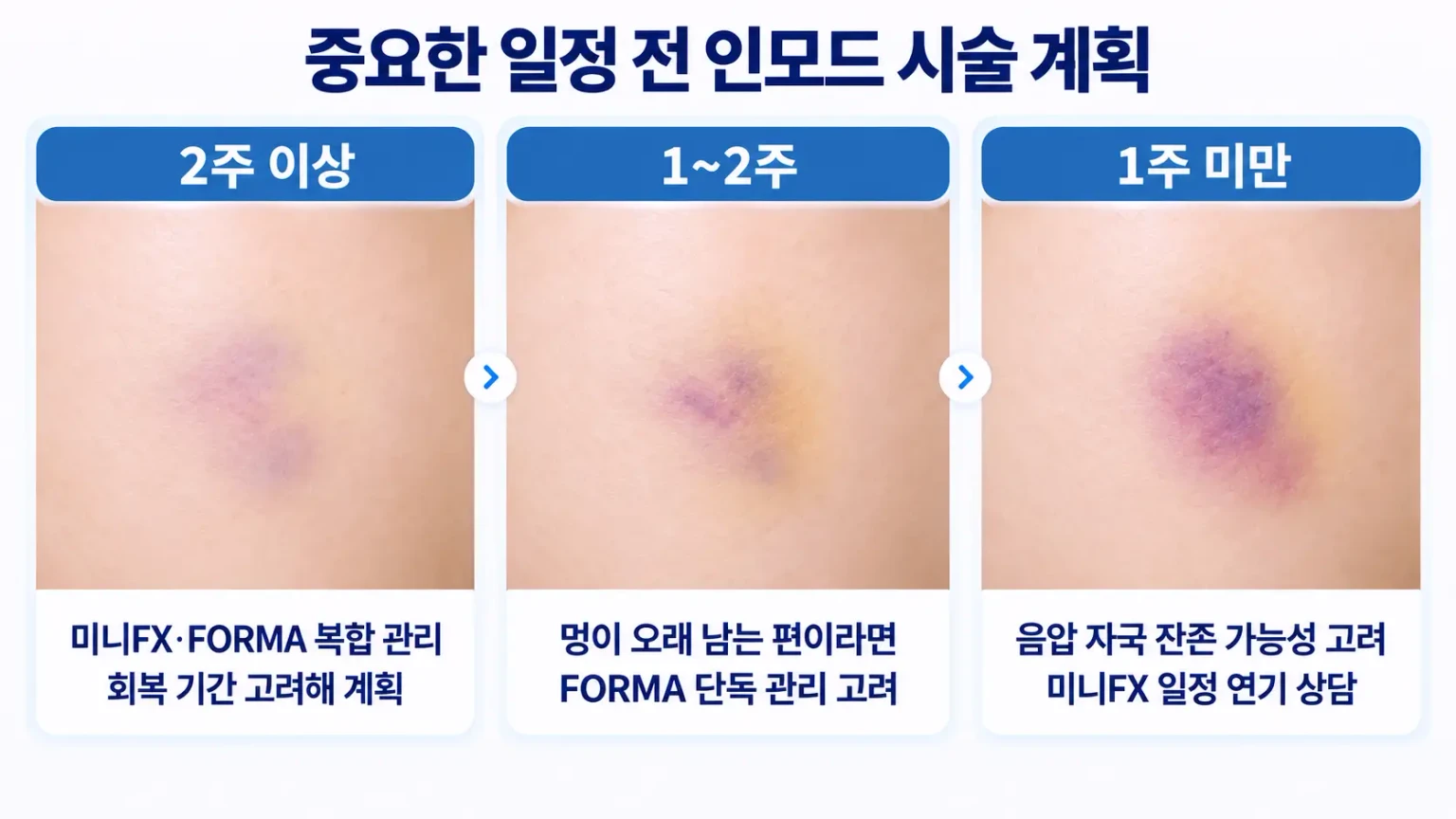 중요한 일정 전 인모드 시술 계획과 멍 회복 기간별 고려사항을 비교한 이미지
