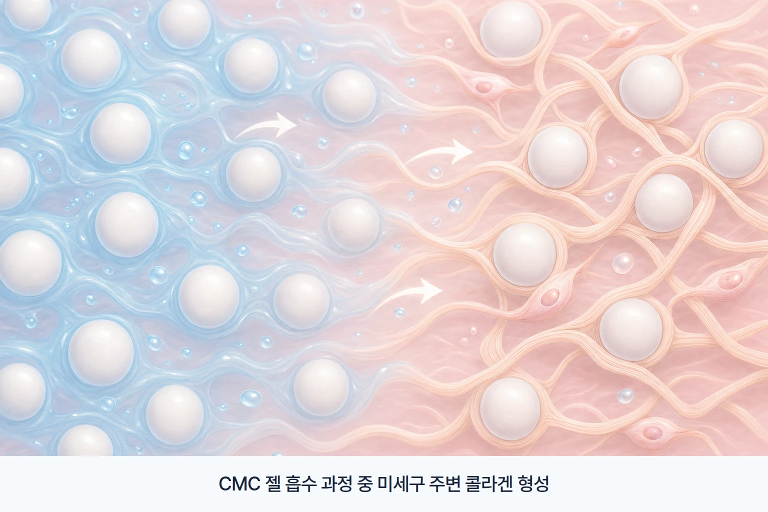 레디어스의 CMC 젤이 흡수되는 과정에서 CaHA 미세구 주변으로 콜라겐 섬유가 형성되는 조직 내 변화
