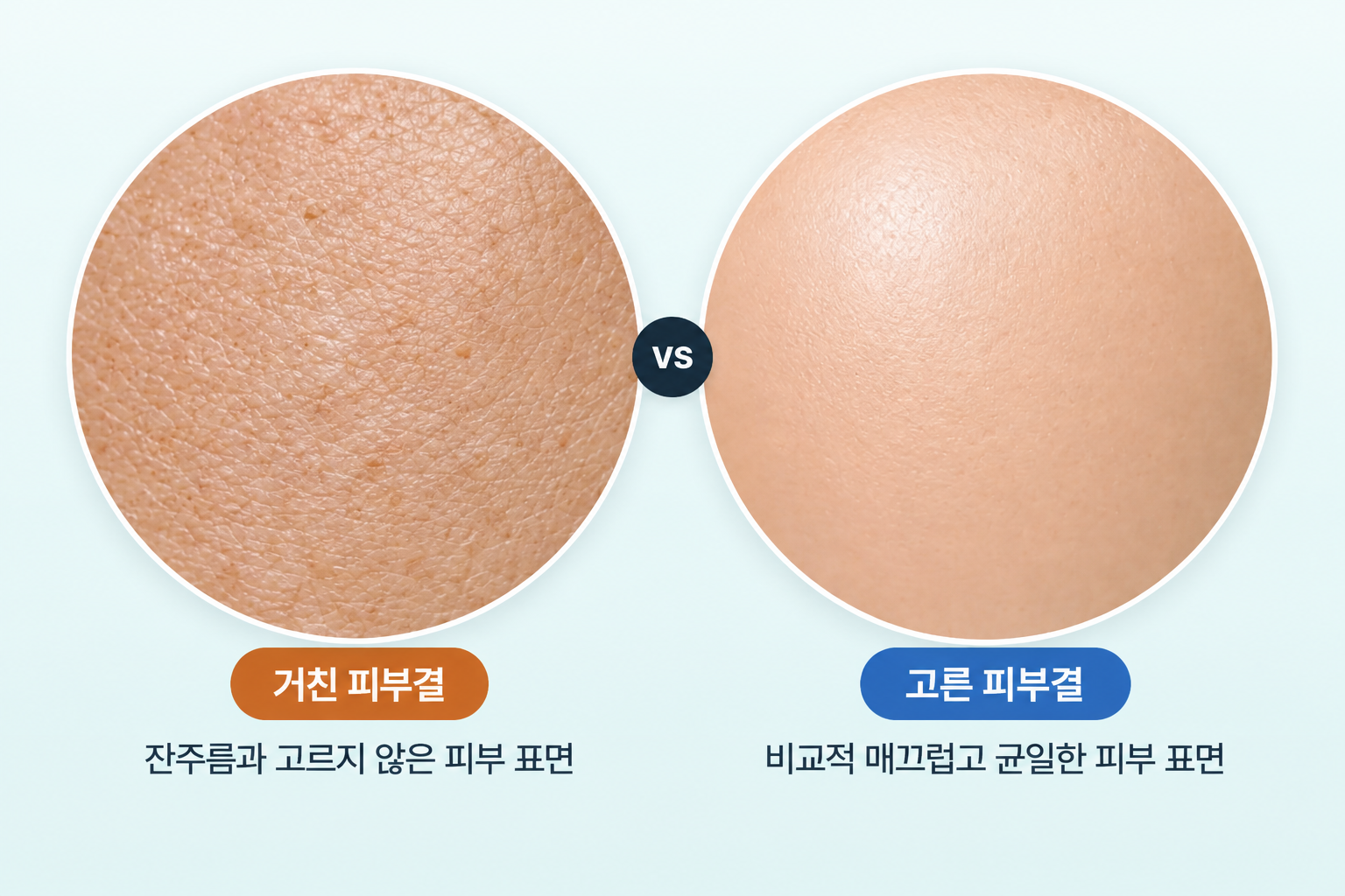 잔주름과 미세한 굴곡이 두드러진 거친 피부 표면과 비교적 매끄럽고 균일한 피부결을 같은 배율로 확대한 비교