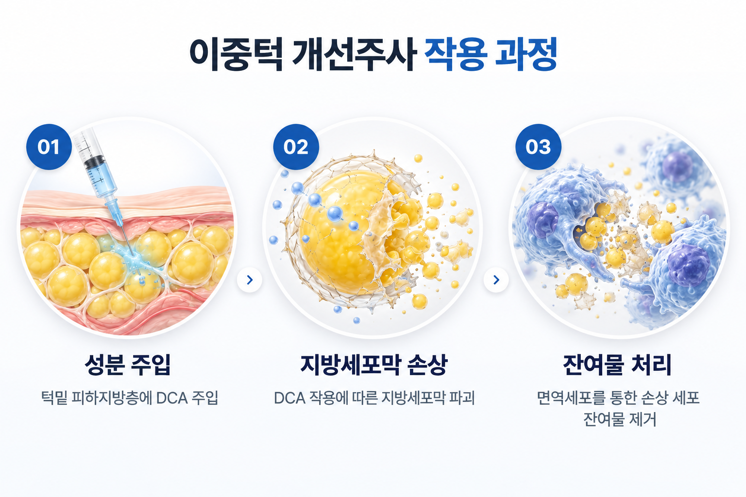 데옥시콜산 성분 주입에 따른 지방세포막 손상과 면역세포의 잔여물 처리 과정