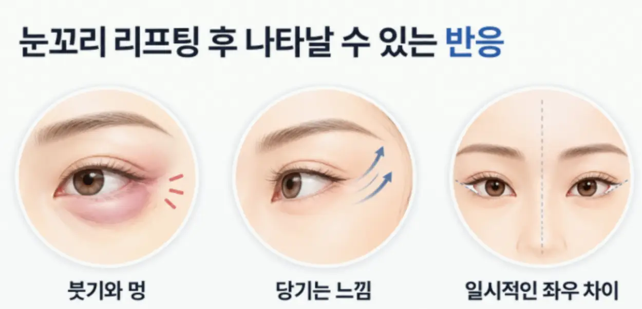 눈꼬리 리프팅 후 나타날 수 있는 반응