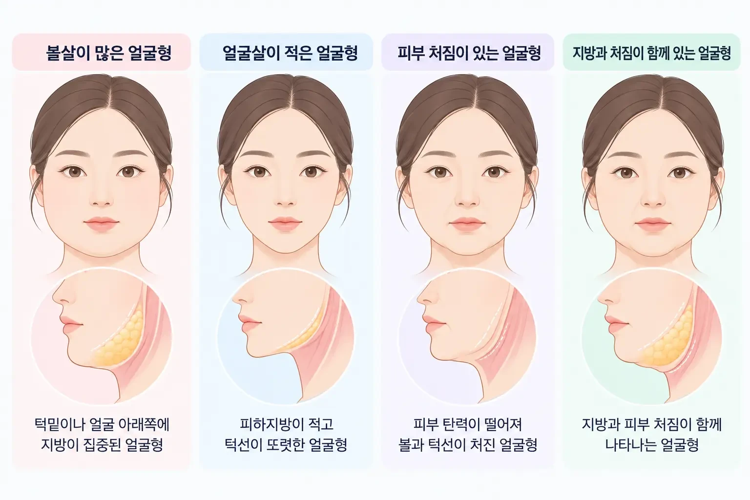 볼살이 많은 얼굴형, 얼굴살이 적은 얼굴형, 피부 처짐이 있는 얼굴형, 지방과 처짐이 함께