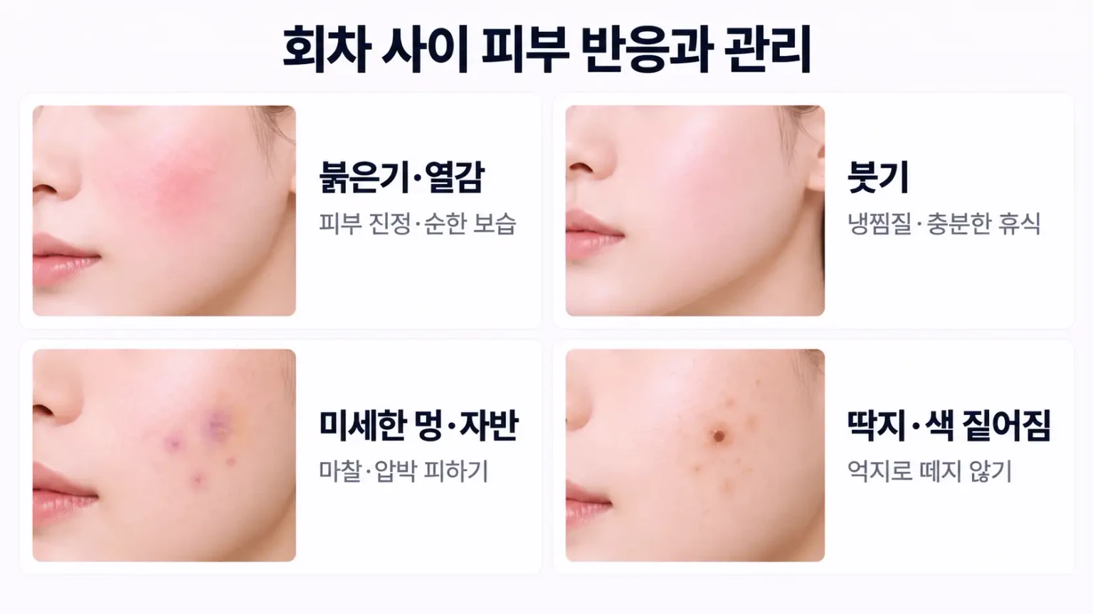 시술 직후, 1~2주, 1개월, 2~3개월 시점별 엑셀브이 효과 변화를 정리한 흐름 이미지