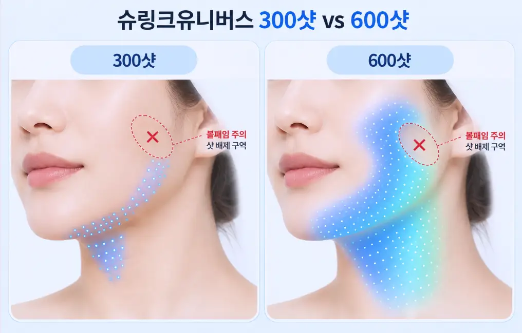 슈링크유니버스 300샷과 600샷 시술 범위 비교 및 옆볼 볼패임 주의 샷 배제 구역 페이스 매핑 인포그래픽