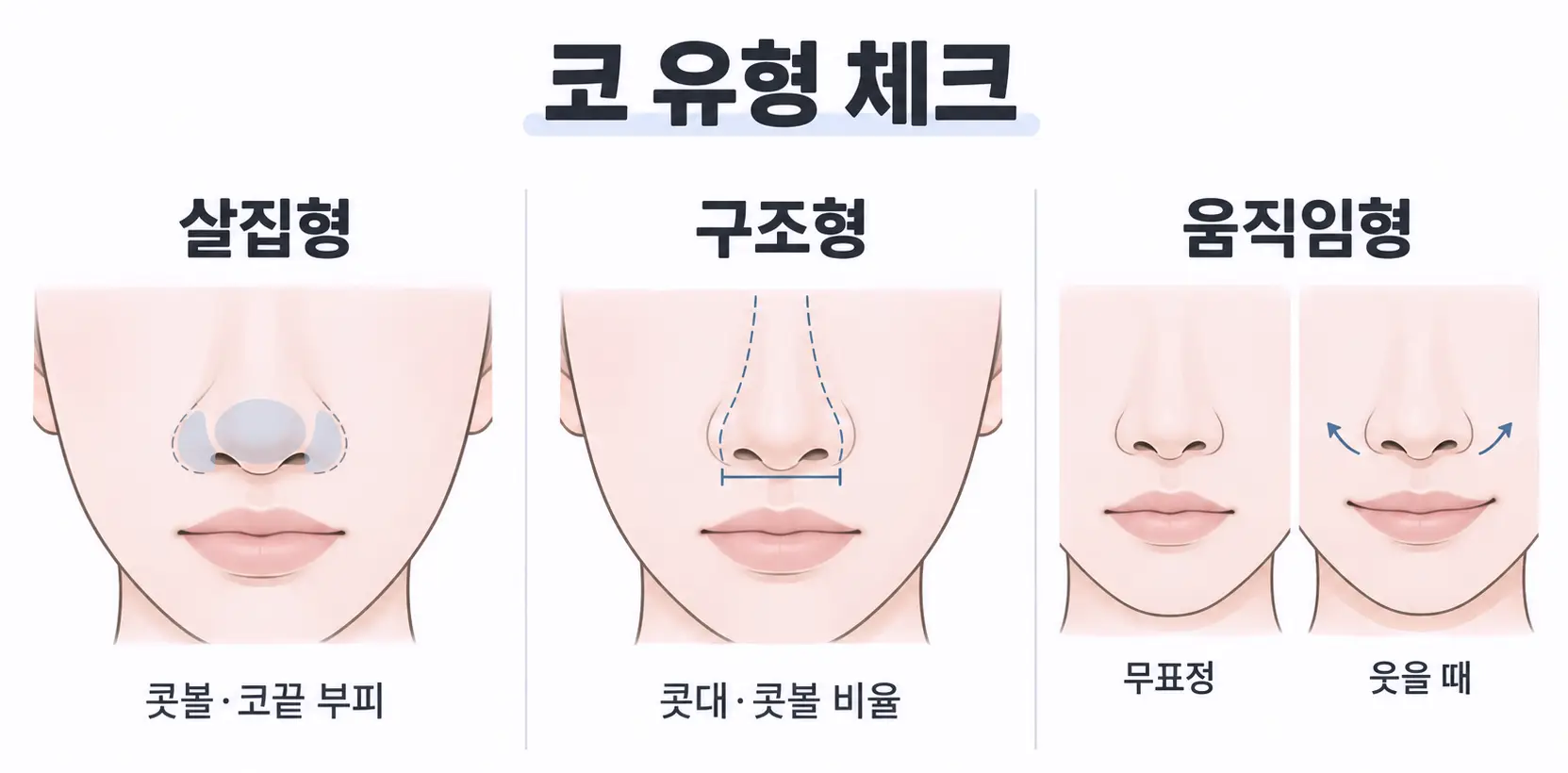 코조각주사 적합 여부를 확인하는 살집형·구조형·움직임형 코 유형 체크리스트