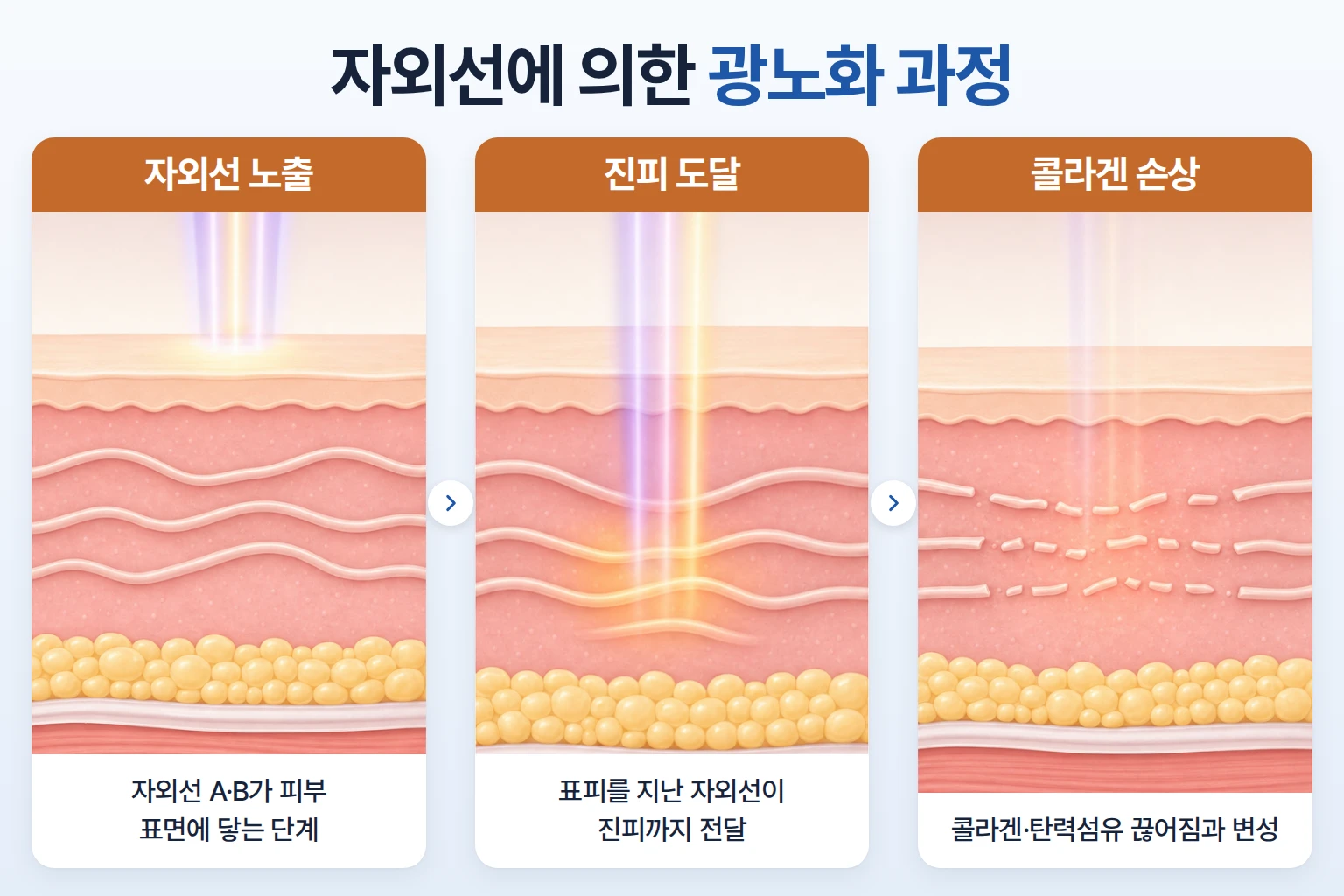 자외선이 진피에 도달해 콜라겐이 손상되는 광노화 과정