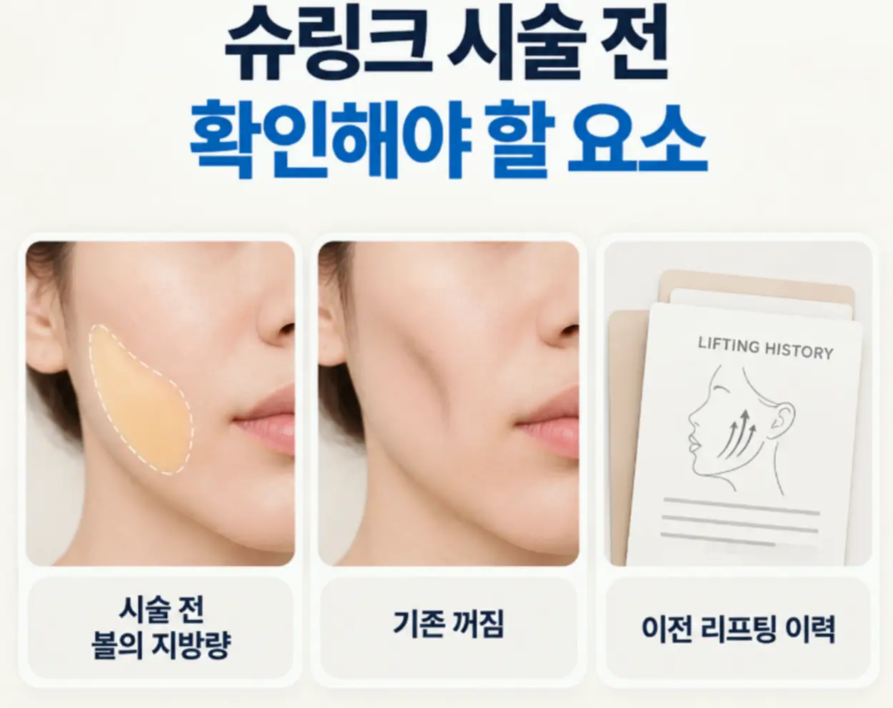슈링크 시술 전 확인해야 할 요소