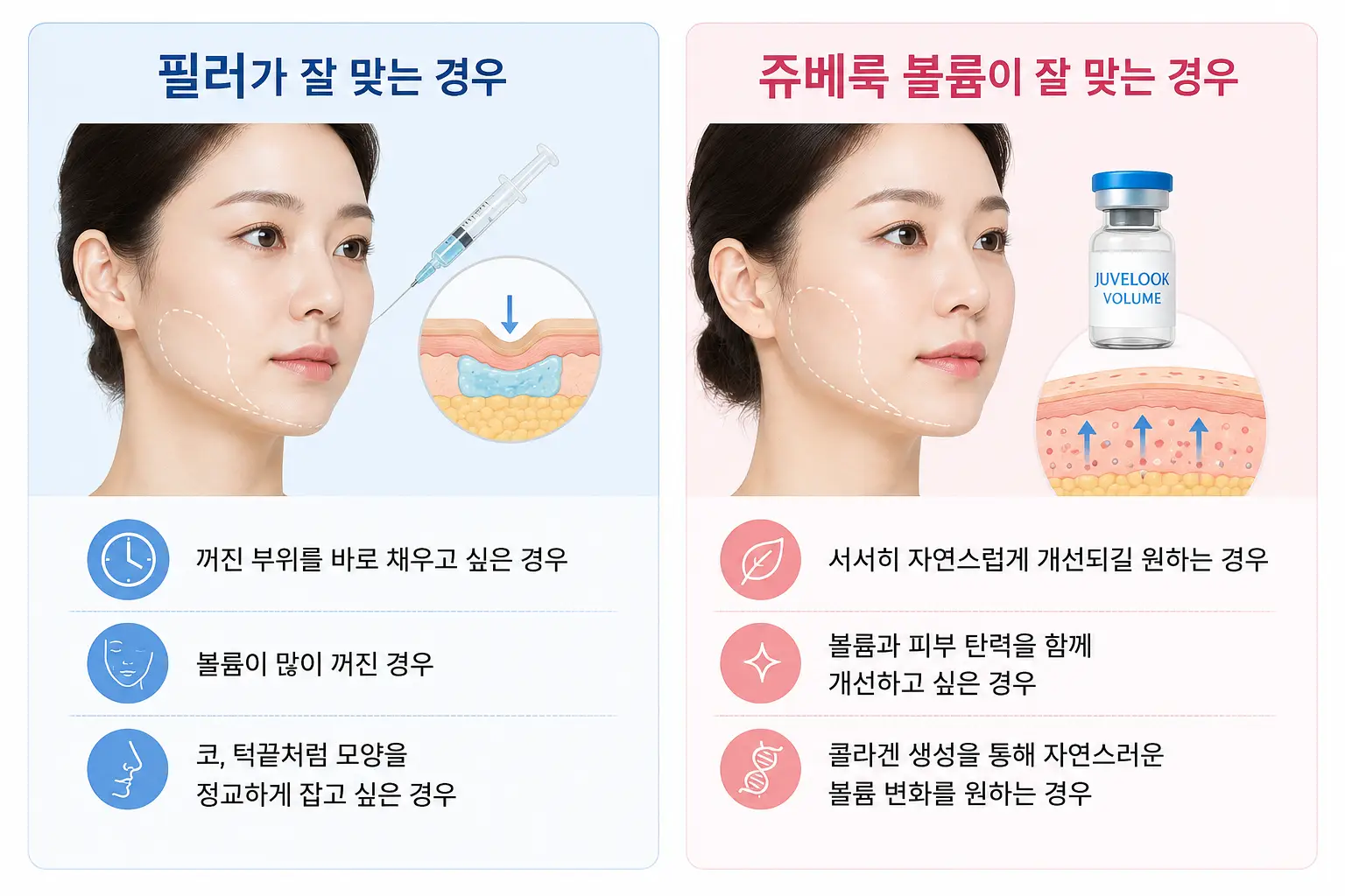 구로피부과_ 필러와 쥬베룩 볼륨이 잘 맞는 경우와 선택 기준 비교