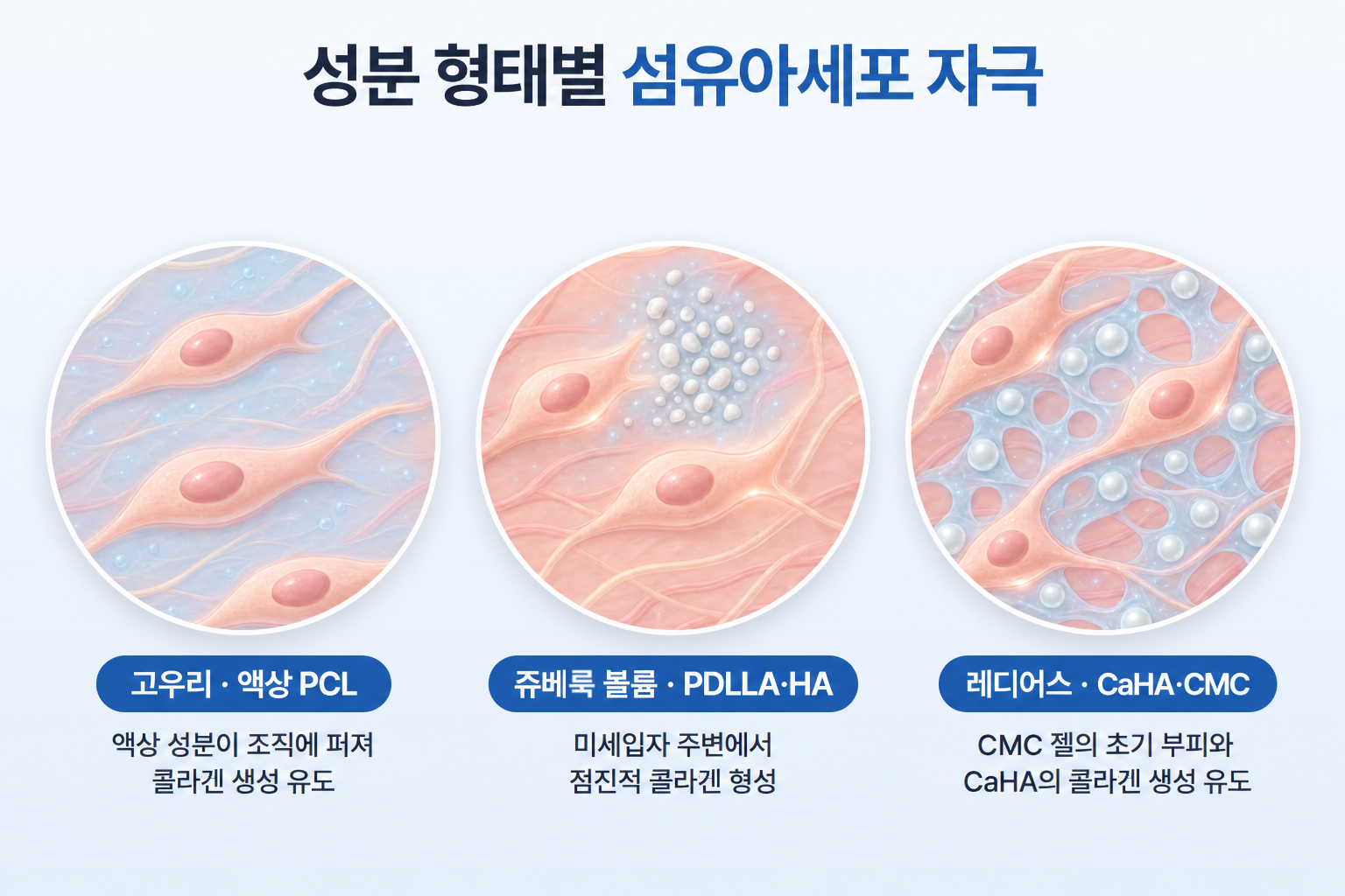 콜라겐 주사 종류별 작용 방식 비교, 고우리 액상 PCL·쥬베룩 볼륨 PDLLA 미세입자·레디어스 CaHA 미세구의 섬유아세포 주변 분포와 콜라겐 생성 유도