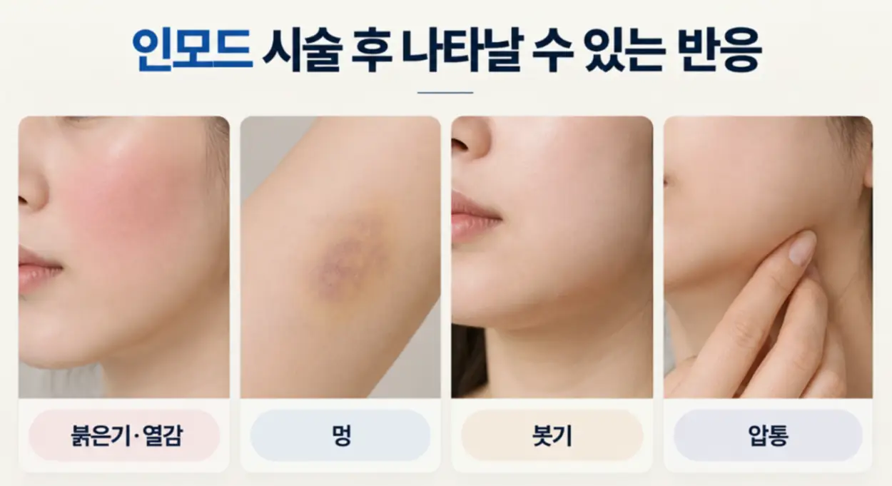 인모드 1회 시술 후 나타날 수 있는 반응
