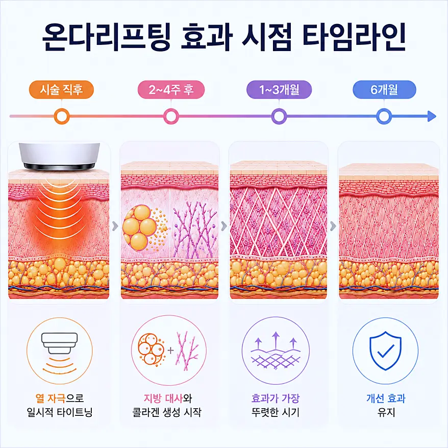 온다리프팅 효과 시점 타임라인 - 2주부터 6개월 유지기간까지