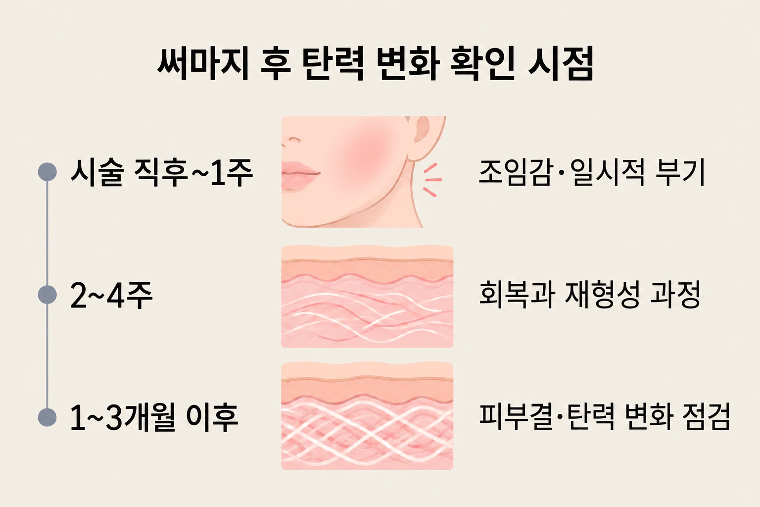 써마지 직후 조임감·부기부터 회복과 피부결·탄력 변화를 살펴보는 흐름