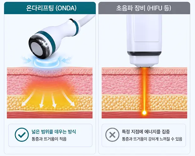 온다리프팅 장비와 초음파 장비의 에너지 전달 방식 차이로 인한 통증 및 열감 낮음