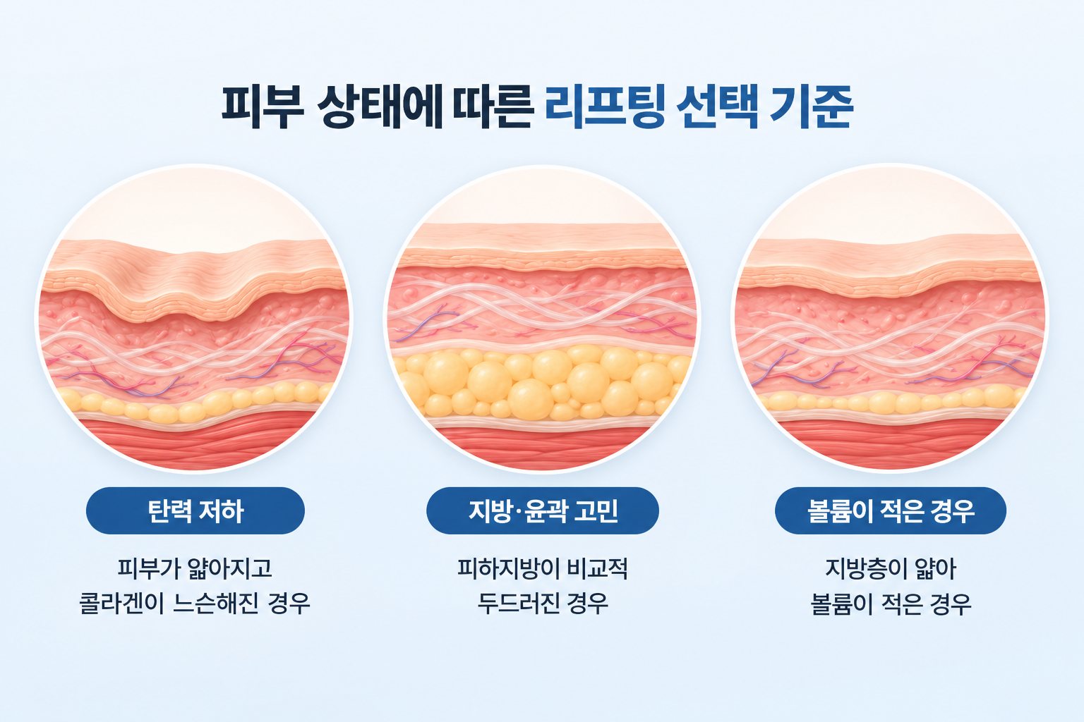 피부 탄력 저하와 지방·윤곽 고민, 볼륨이 적은 피부 상태 비교