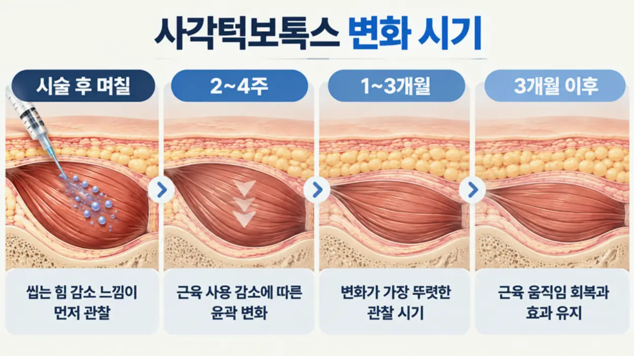 사각턱보톡스 주기 및 효과