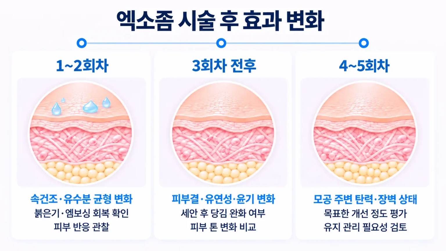 엑소좀 시술 후 피부 진정, 수분감, 피부결과 탄력 변화 과정을 나타낸 이미지
