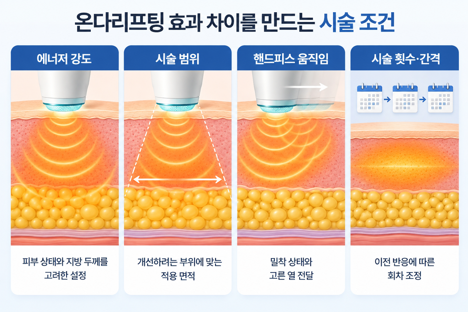 온다리프팅 효과 차이에 영향을 줄 수 있는 에너지 강도, 시술 면적, 핸드피스 밀착과 움직임, 이전 피부 반응에 따른 시술 횟수와 간격 조정