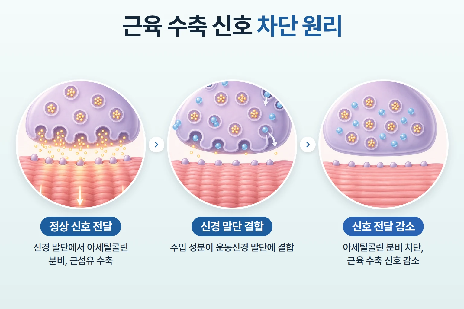 운동신경 말단의 아세틸콜린 분비가 차단되어 근육 수축 신호가 줄어드는 과정을 나타낸 개념도