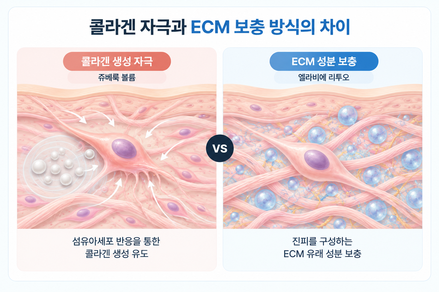 쥬베룩 볼륨의 섬유아세포 자극을 통한 콜라겐 생성 유도와 엘라비에 리투오의 진피 ECM 성분 직접 보충 방식 비교