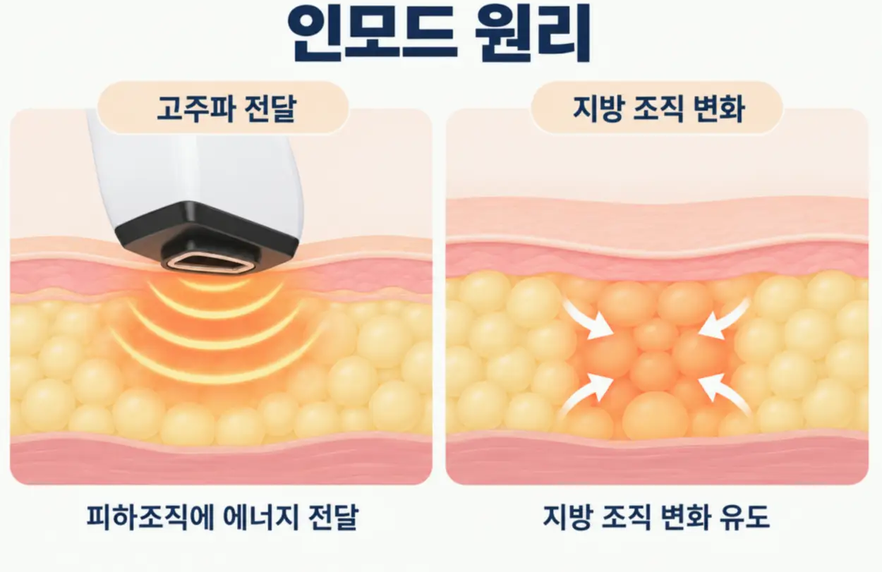 인모드효과없음 확인하기 전 알아야 할 원리